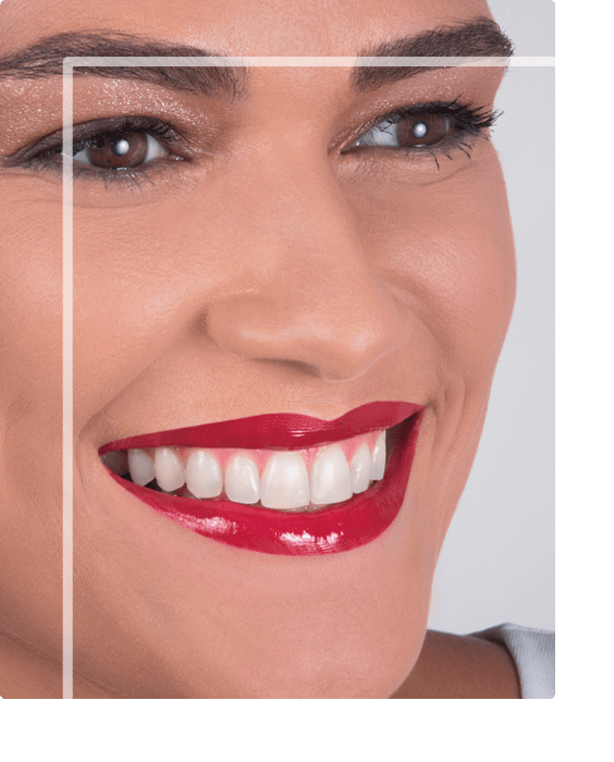 Clareamento Dental em Santa Rosa - BH